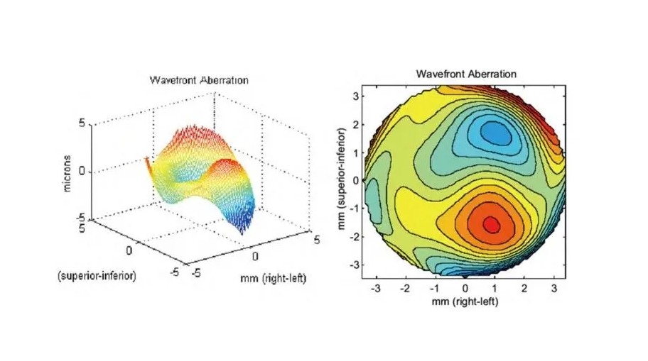 波前像差(波陣面像差)的基本知識(shí) 波前像差(波陣面像差)的基本知識(shí)